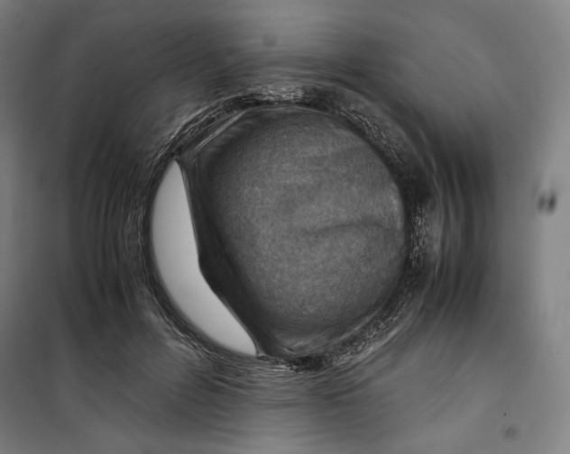 X0000099530600200806061433