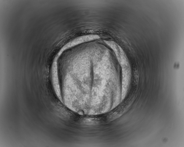 X0000099530657200806061433