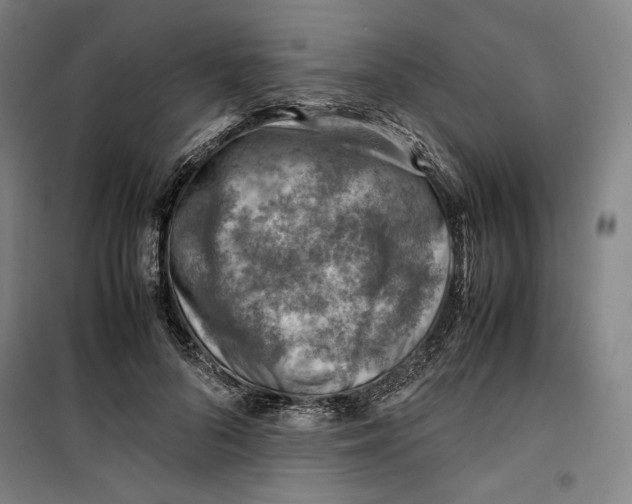 X0000099530696200806061432