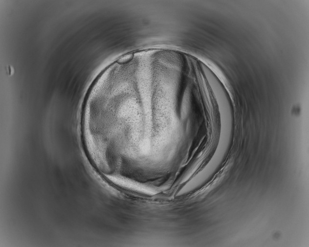 X0000099530957200806061428