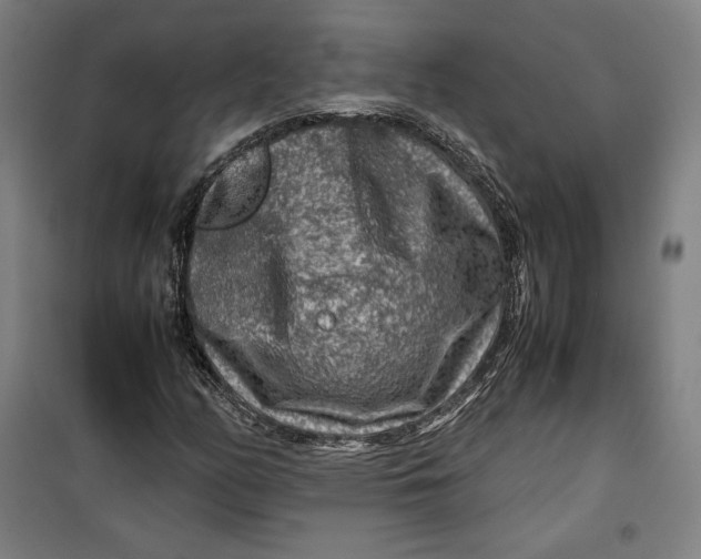 X0000099531158200806061425