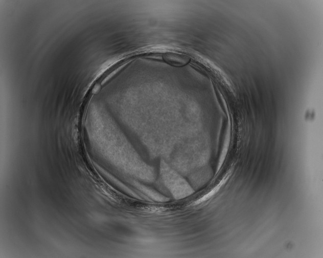 X0000099531170200806061425