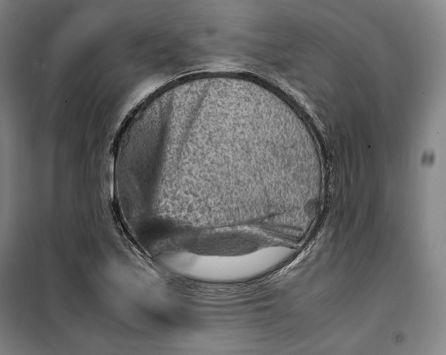 X0000099531171200806061425