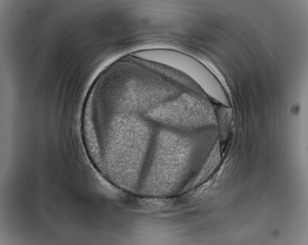 X0000099531197200806061424