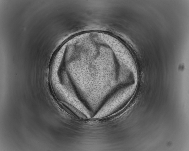 X0000099531220200806061424