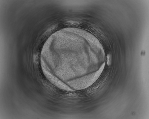 X0000099531395200806061420