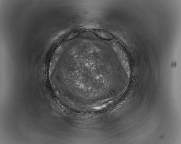 X0000099531398200806061421