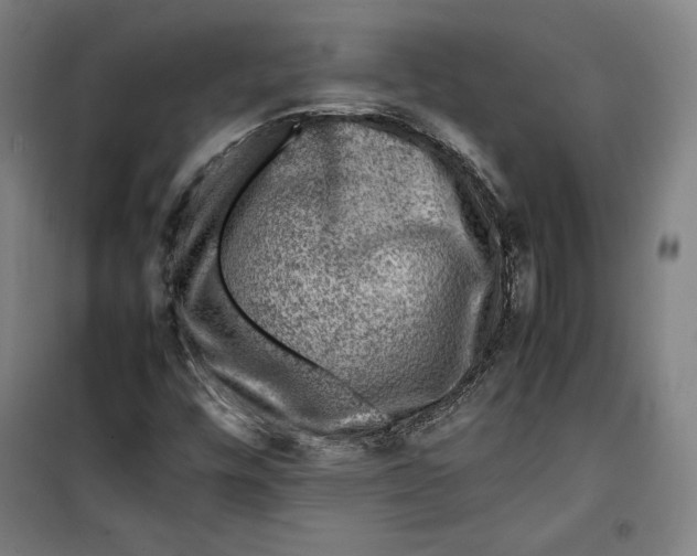 X0000099531448200806061420