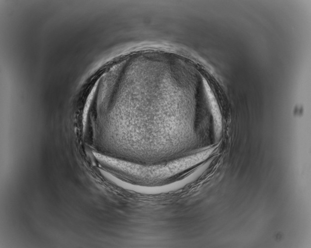 X0000099531496200806061419