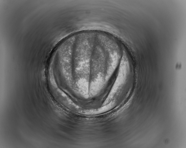 X0000099531497200806061419