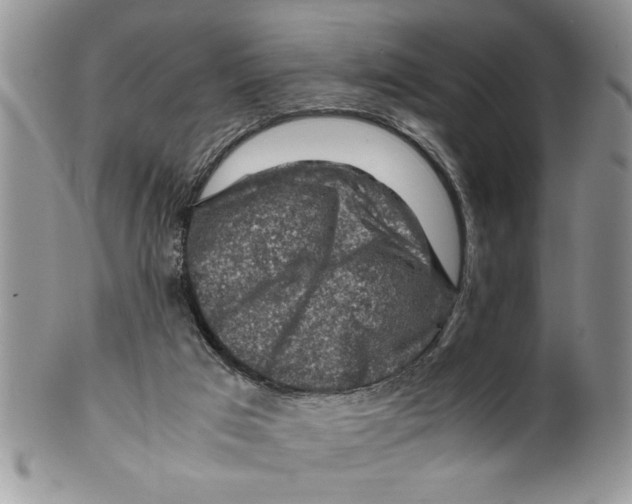 X0000099530017200806131137