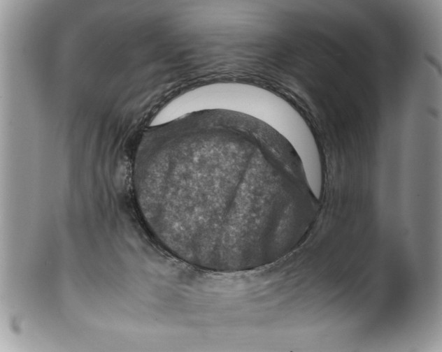 X0000099530029200806131137