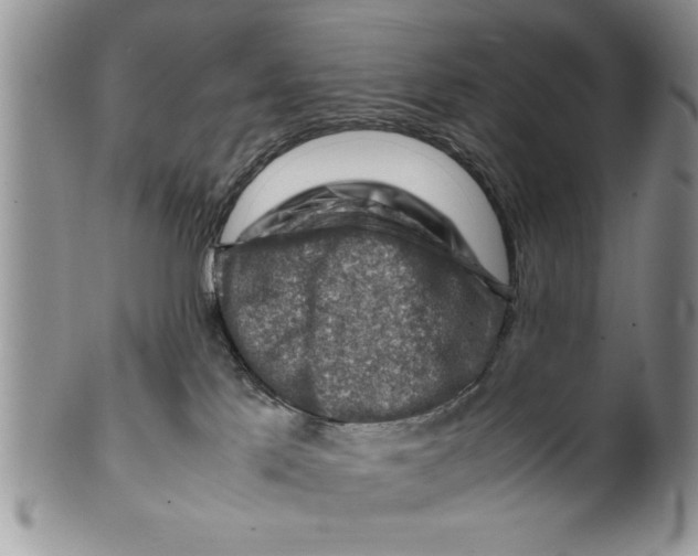 X0000099530041200806131137