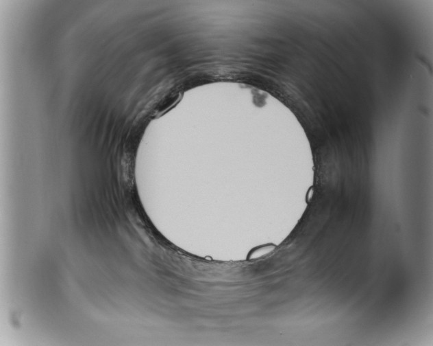 X0000099530044200806131137