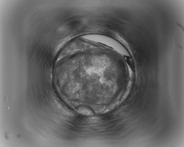 X0000099530059200806131136