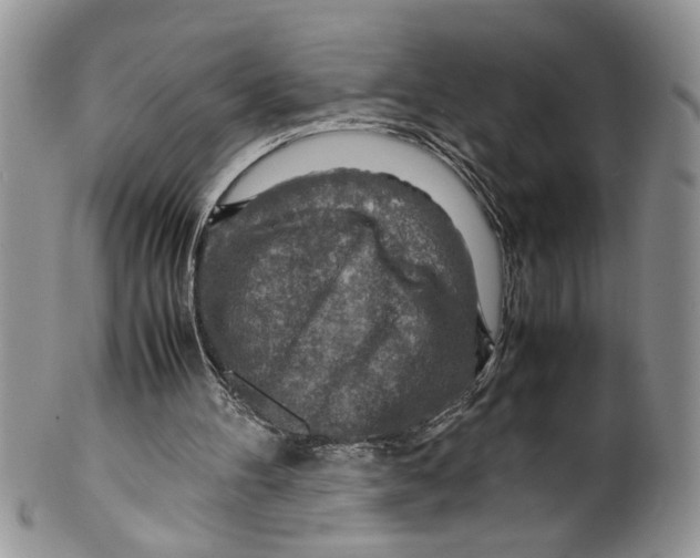 X0000099530100200806131136