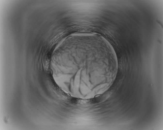 X0000099530139200806131135