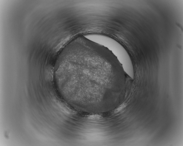 X0000099530168200806131135