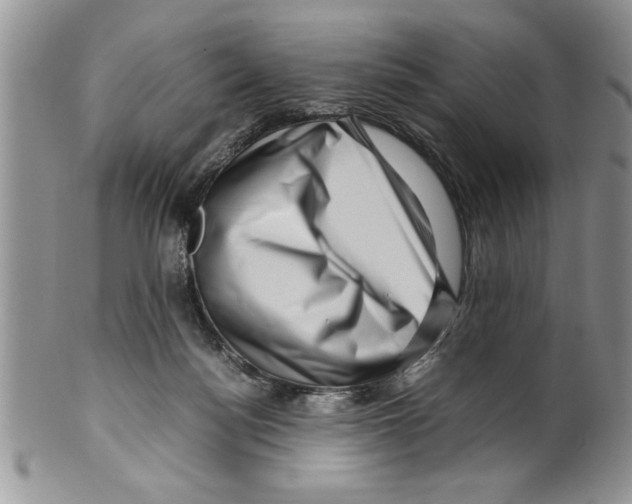 X0000099530172200806131135