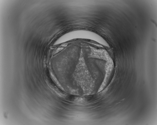 X0000099530174200806131135