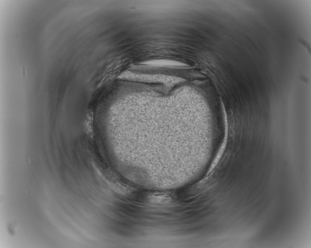 X0000099530175200806131135