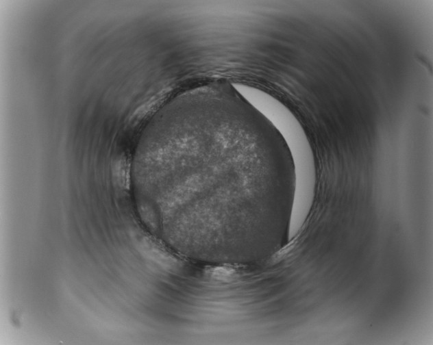 X0000099530180200806131135