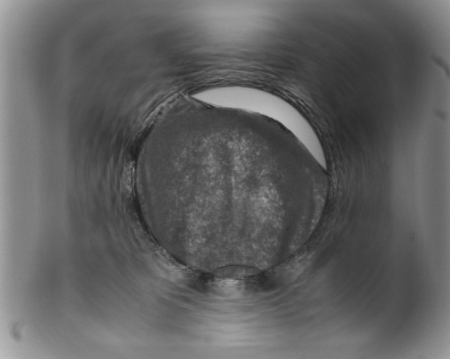 X0000099530325200806131133