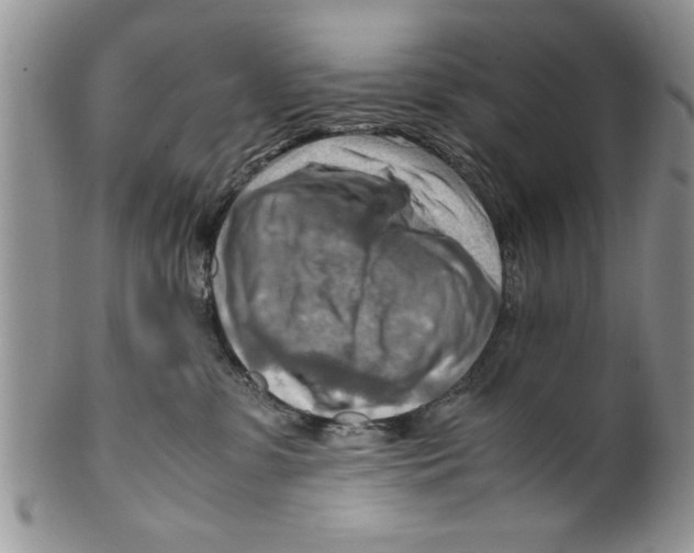 X0000099530331200806131133