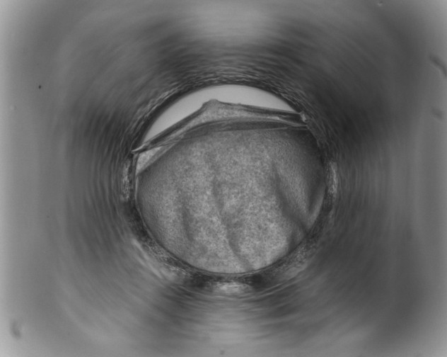 X0000099530360200806131132