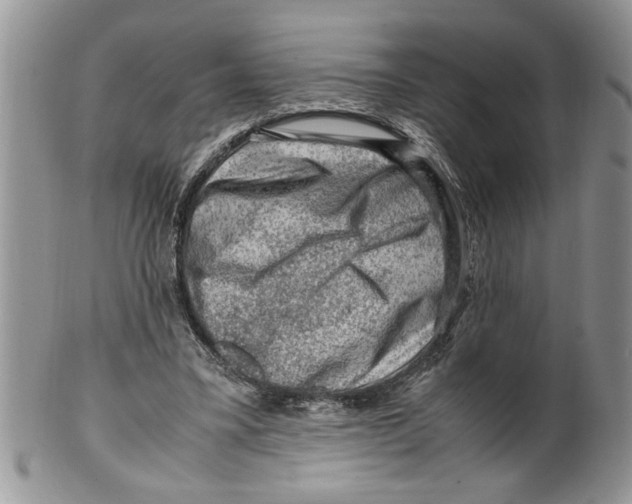 X0000099530395200806131132