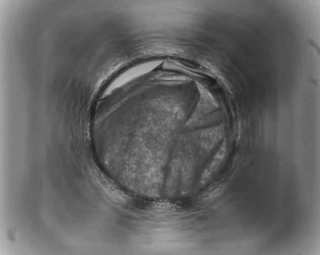 X0000099530399200806131132