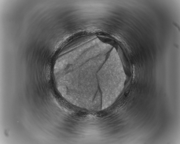 X0000099530496200806131130