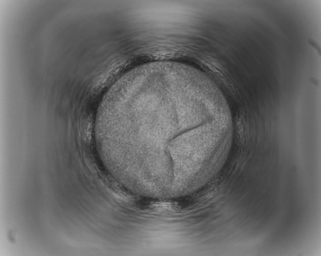 X0000099530499200806131130