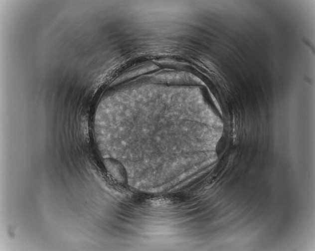 X0000099530500200806131130