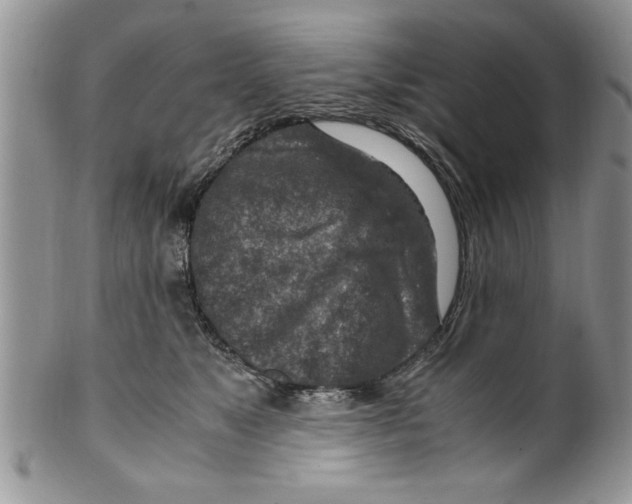 X0000099530517200806131130