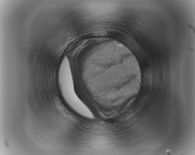 X0000099530600200806131129