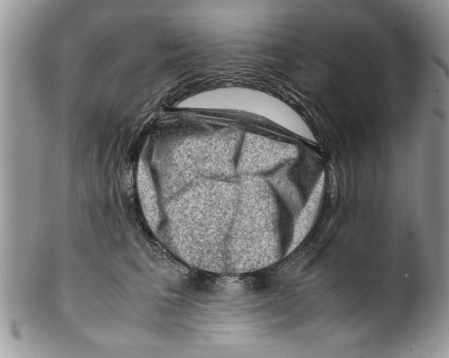 X0000099530613200806131129