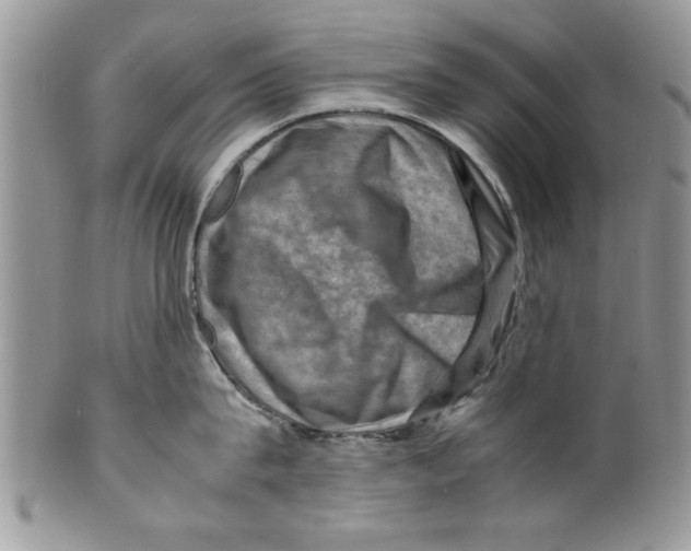 X0000099530815200806131126