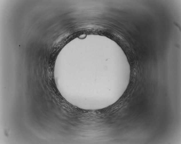 X0000099530869200806131125