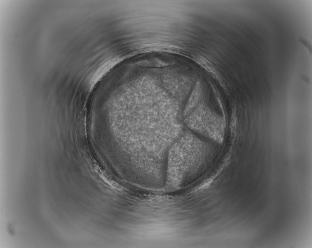 X0000099530877200806131125