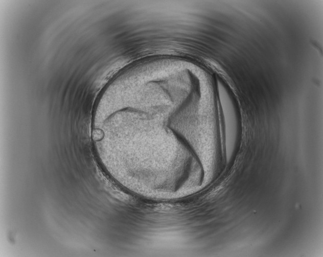 X0000099530938200806131124