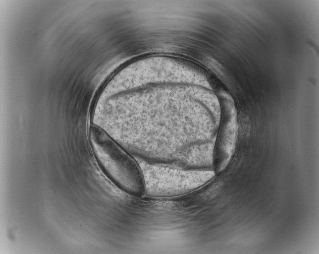 X0000099530940200806131124