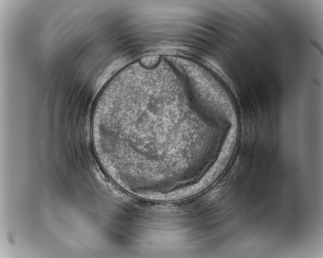 X0000099530994200806131123