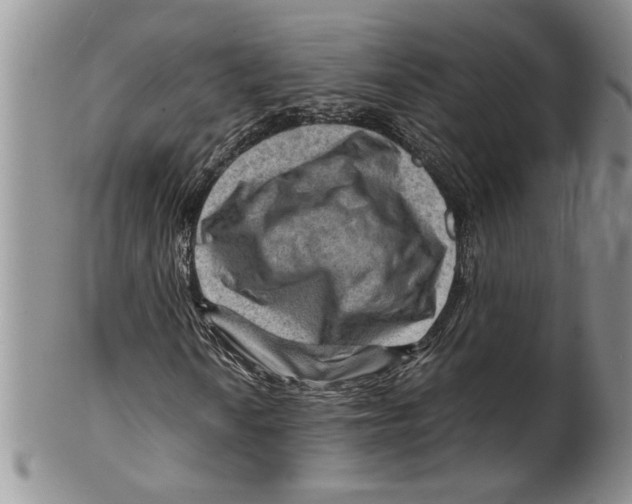 X0000099531010200806131123