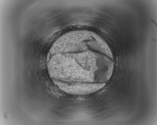 X0000099531014200806131123