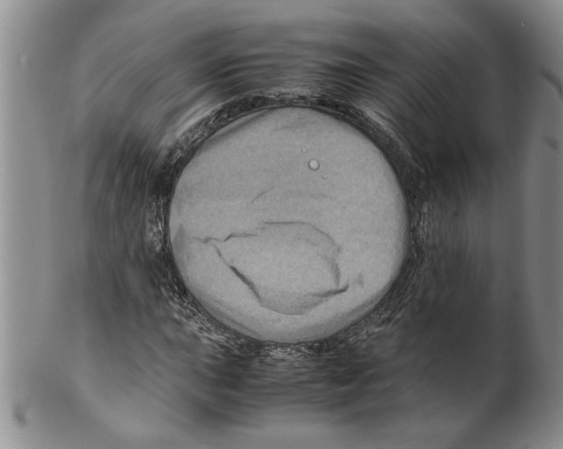 X0000099531015200806131123