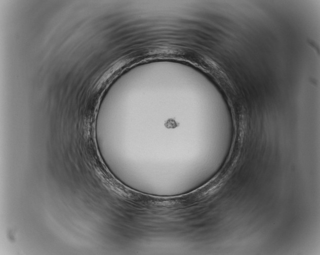 X0000099531017200806131123