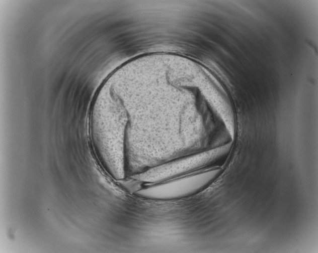 X0000099531044200806131123