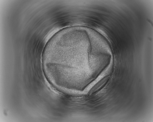 X0000099531047200806131123