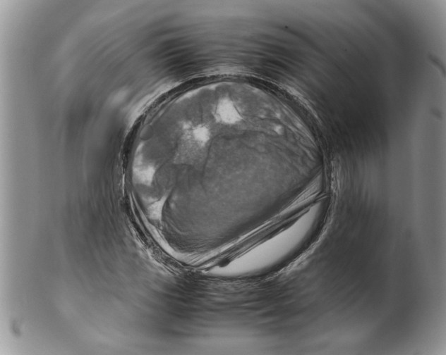 X0000099531117200806131121